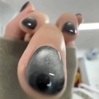 Naildog